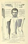 highgradehospita00woch_Page_136