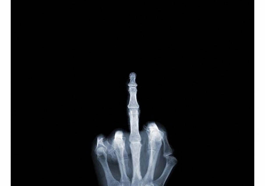 X ray Finger