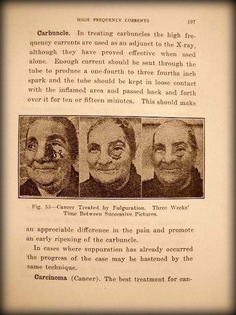 Page_197